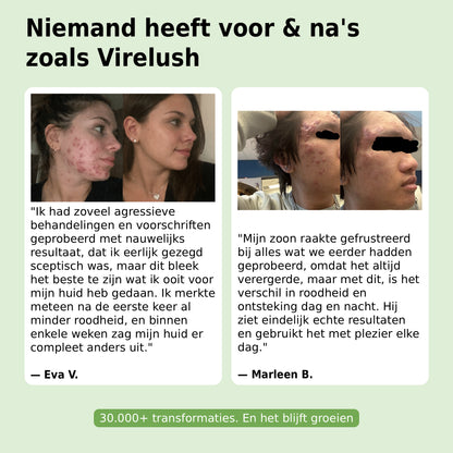 Dood Acne en Roodheid - Ritueel